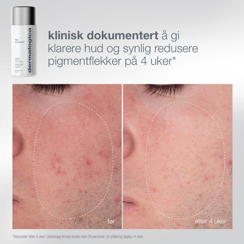 Dermalogica Pro Ritual: Exfoliate + Glow