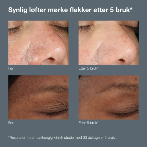 Dermalogica Powerbright - Dark Spot Peel 50ml